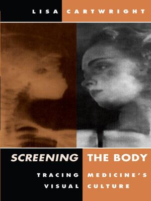 cover image of Screening the Body